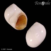 Image of Polinices tumidus (Tumid moon snail)